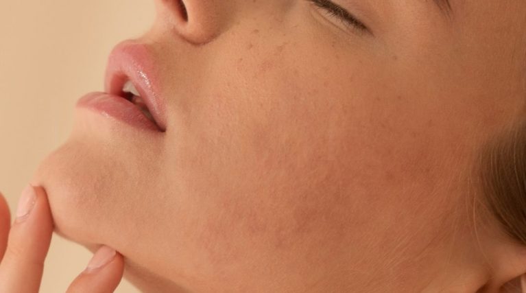 Gıdı Vaser Lipo kıbrıs Gıdı Vaser Lipo kıbrıs