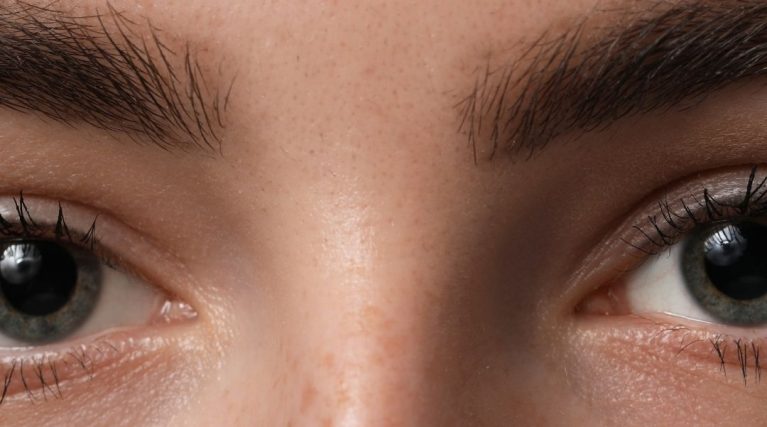 Kaş Arası (Glabella) Botoksu