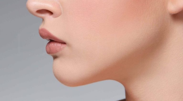 Masseter (Çene Botoksu)