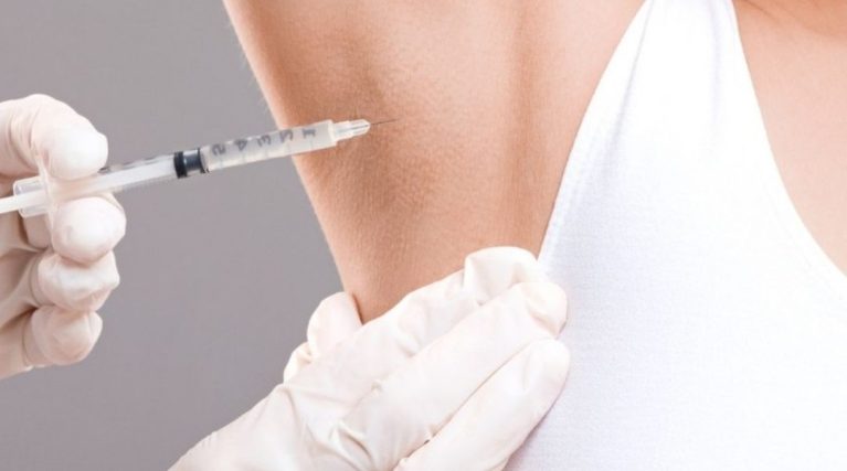 Terleme Tedavisi (Hiperhidroz Botoksu) kıbrıs