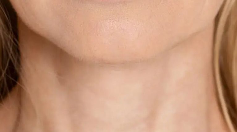 boyun-botox-kibris